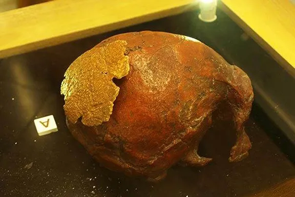 Disputed skull fragment
